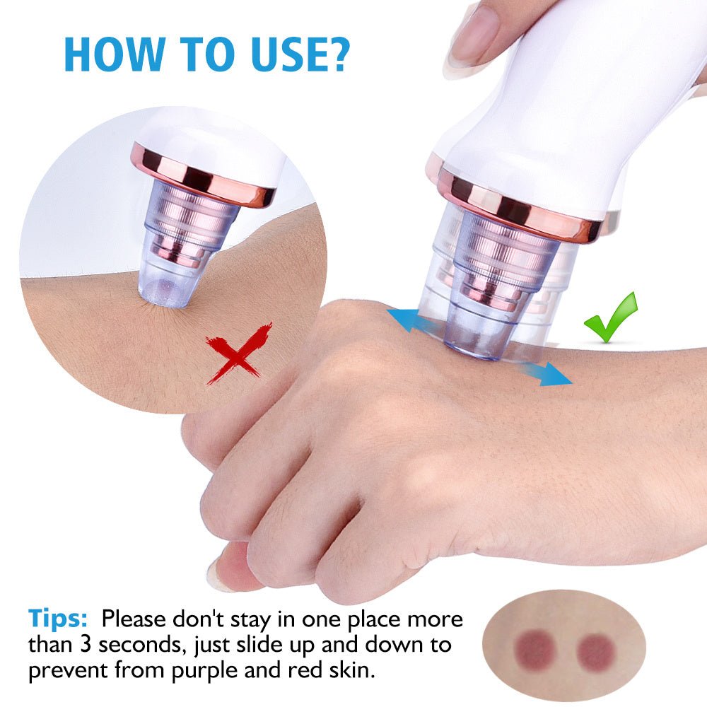 Blackhead Electric Suction Facial - HausOfThreads®