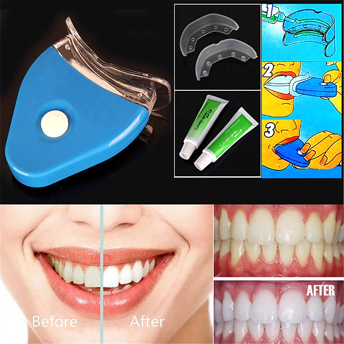 Tooth Whitener 